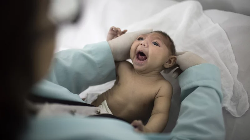 Effect of the virus in newborns if the mother was infected by Zika 